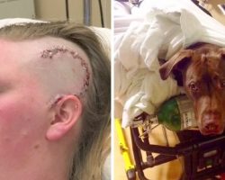 Dog Sees Woman Passing Out After Violent Seizure, Now He Never Leaves Her Side