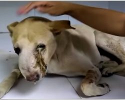 Tumor Made Him Cry Pus & No One Would Touch Him Till God Sent Him His Way