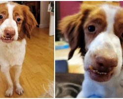 Left With A Wonky Face After Being Badly Abused, He Ached For Love & Acceptance