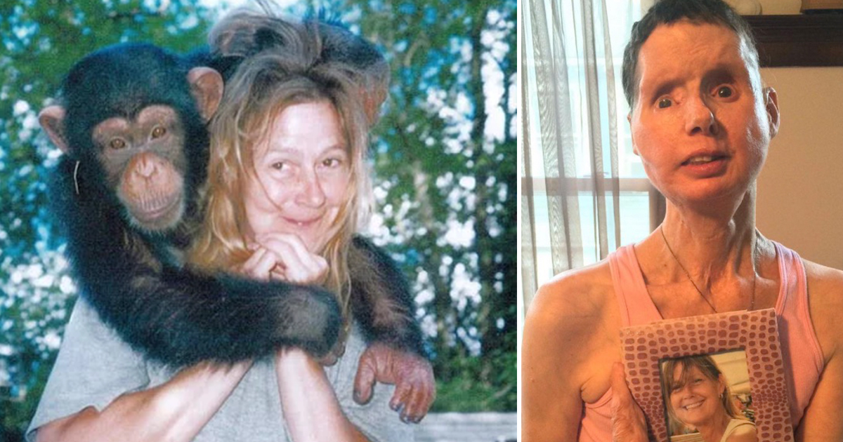 The Unthinkable Attack That Changed Charla Nash’s Life Forever
