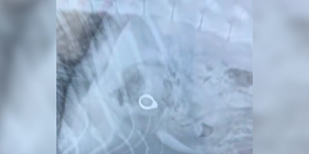 Vet Can’t Stop Laughing After Discovering What Happened To Woman’s Missing Engagement Ring