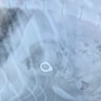 Vet Can’t Stop Laughing After Discovering What Happened To Woman’s Missing Engagement Ring